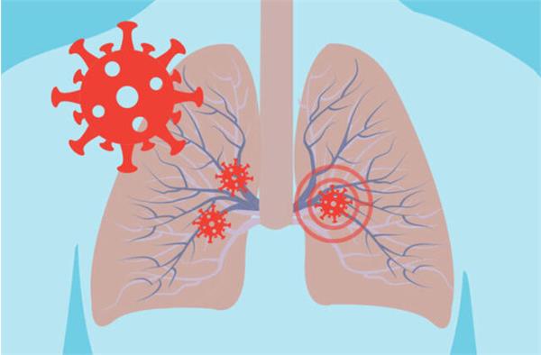 تایید ارتباط نارساییِ تنفسی ناشی از کرونا با گروه‌ خونی