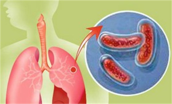 تب، سرفه و خلط خونی را جدی بگیرید