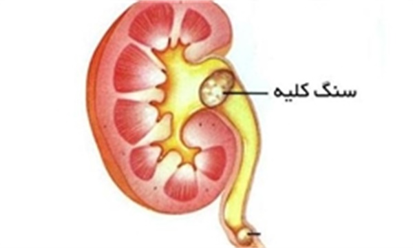 مصرف ماست همراه با انواع ترشی ممنوع