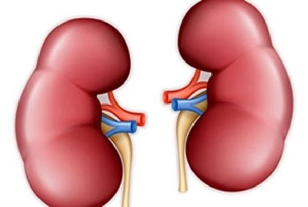 علائم سنگ کلیه را بشناسید